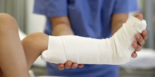 Latest Technique to treat Fractures service image