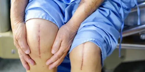 Knee Replacement service image