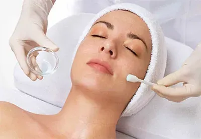 Chemical Peel service image