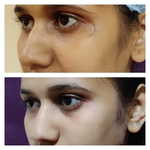 SCAR REVISION service image