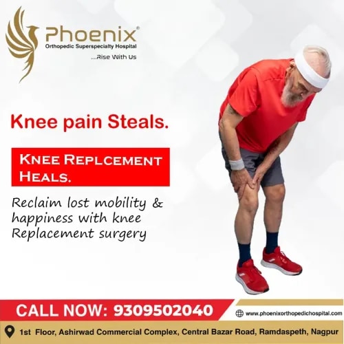 Knee Replacement Surgery service image