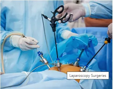 LAPAROSCOPY SURGERIES service image