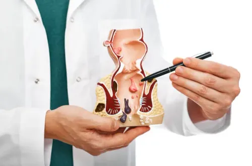 Colon cancer treatment service image