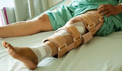 Fracture Surgery service image