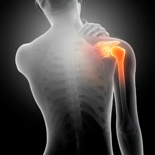 Labral Repair Treatment service image