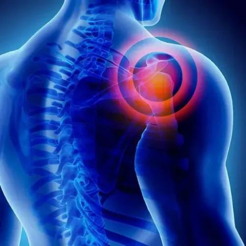 Frozen Shoulder Treatment service image
