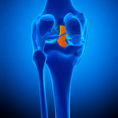 PCL Treatment service image