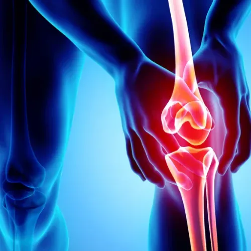 Patellar Instability Treament service image
