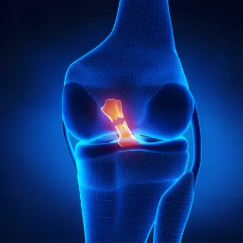 ACL Treatment service image