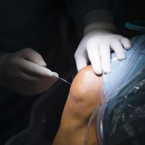 Knee Arthroscopy Treatment service image