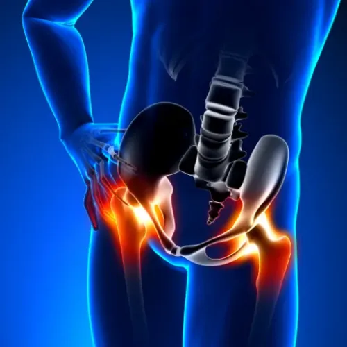  Total Hip Replacement Treatment service image