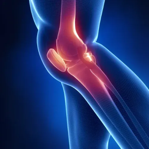 Knee Replacement Treatment service image