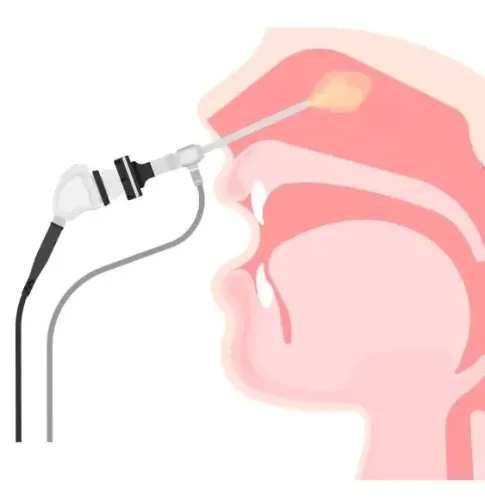 Endoscopic Nasal and Sinus  Surgeries service image
