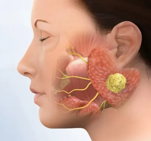 Salivary Gland Surgery service image