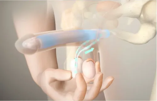Penile Implant Surgeries service image
