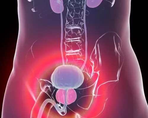 Prostatic Diseases service image