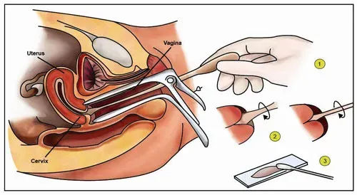 Pap Smear service image