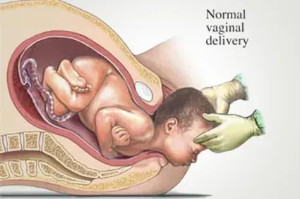 Normal Labour Delivery service image