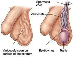 Testicular surgeries service image