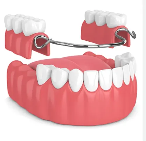 Dentures & Dental Prosthics service image
