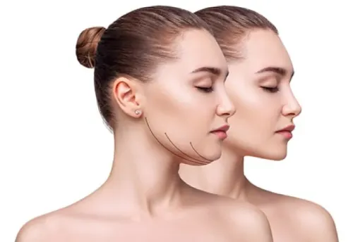 DOUBLE CHIN REDUCTION service image