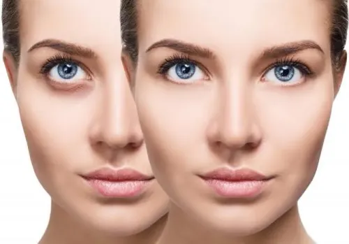 EYE PEEL service image