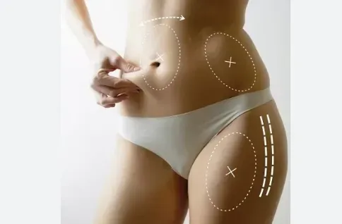 BODY FILLERS service image