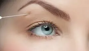 EYEBROW LIFT service image