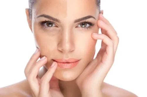PIGMENT REDUCTION LASER service image
