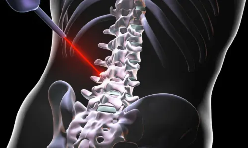 Spine Surgery Specialist in Pune service image