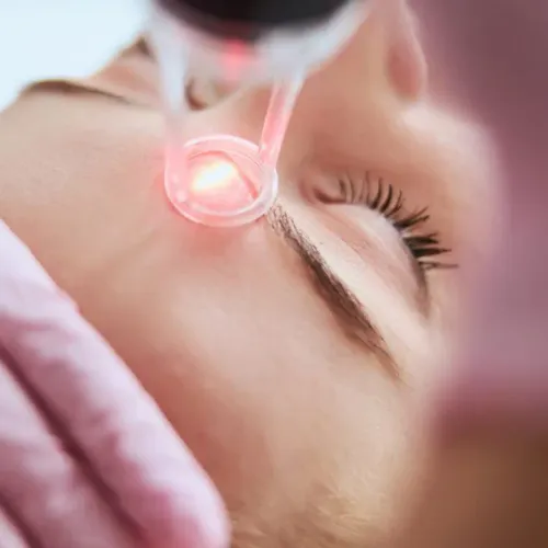 Pico Laser Treatment in Thane service image