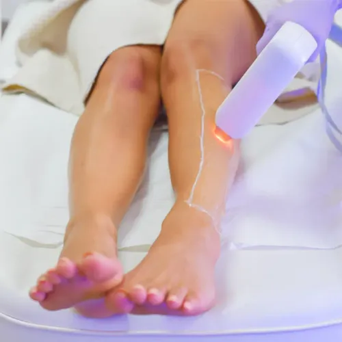 LHR (Laser Hair Reduction) in Thane service image