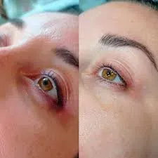 EYE PEEL service image