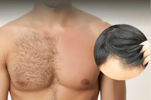 BODY HAIR TRANSPLANT service image