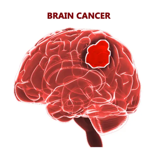 Brain Cancer  service image