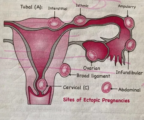 Ectopic Pregnancy service image