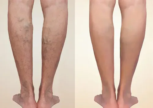 Vascular Specialist in Baner, Aundh, Pune service image