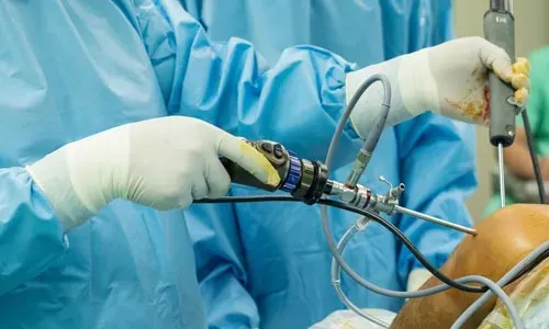 Arthroscopy service image