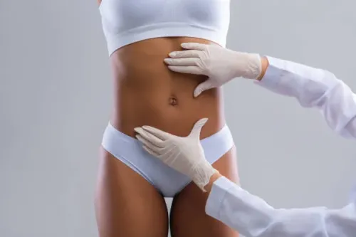Body Lifting Treatment service image