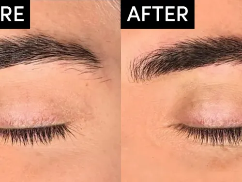 Microblading of Eyebrows service image