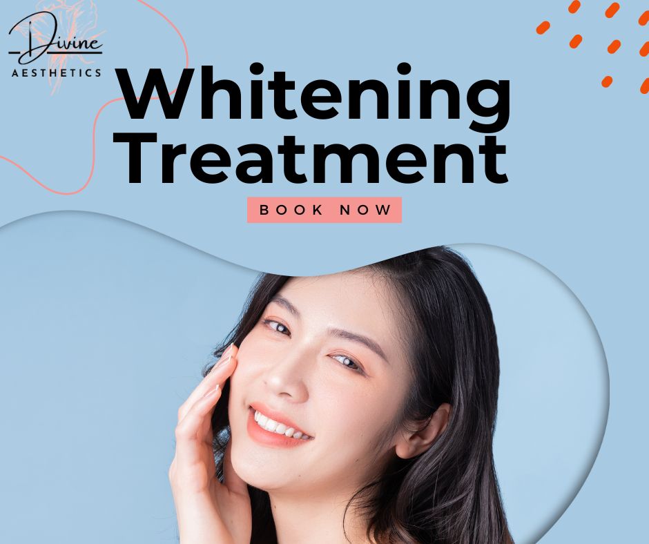 Whitening