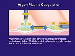 Argon Plasma Coagulation(APC) service image