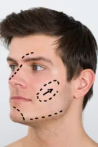 Face lift - Plastic surgery for men service image