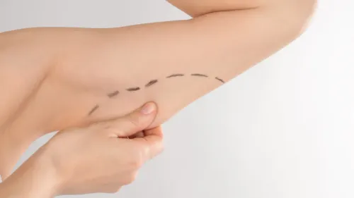 Arm lift service image