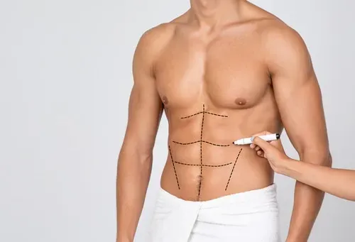 Liposuction service image