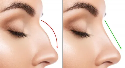 Rhinoplasty service image