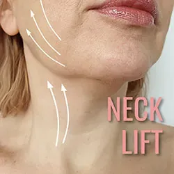 Neck Lift service image