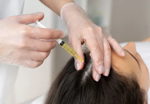 Mesotherapy service image