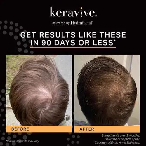 Keravive (Scalp Facial) service image