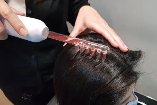 Anti-Dandruff Treatment service image